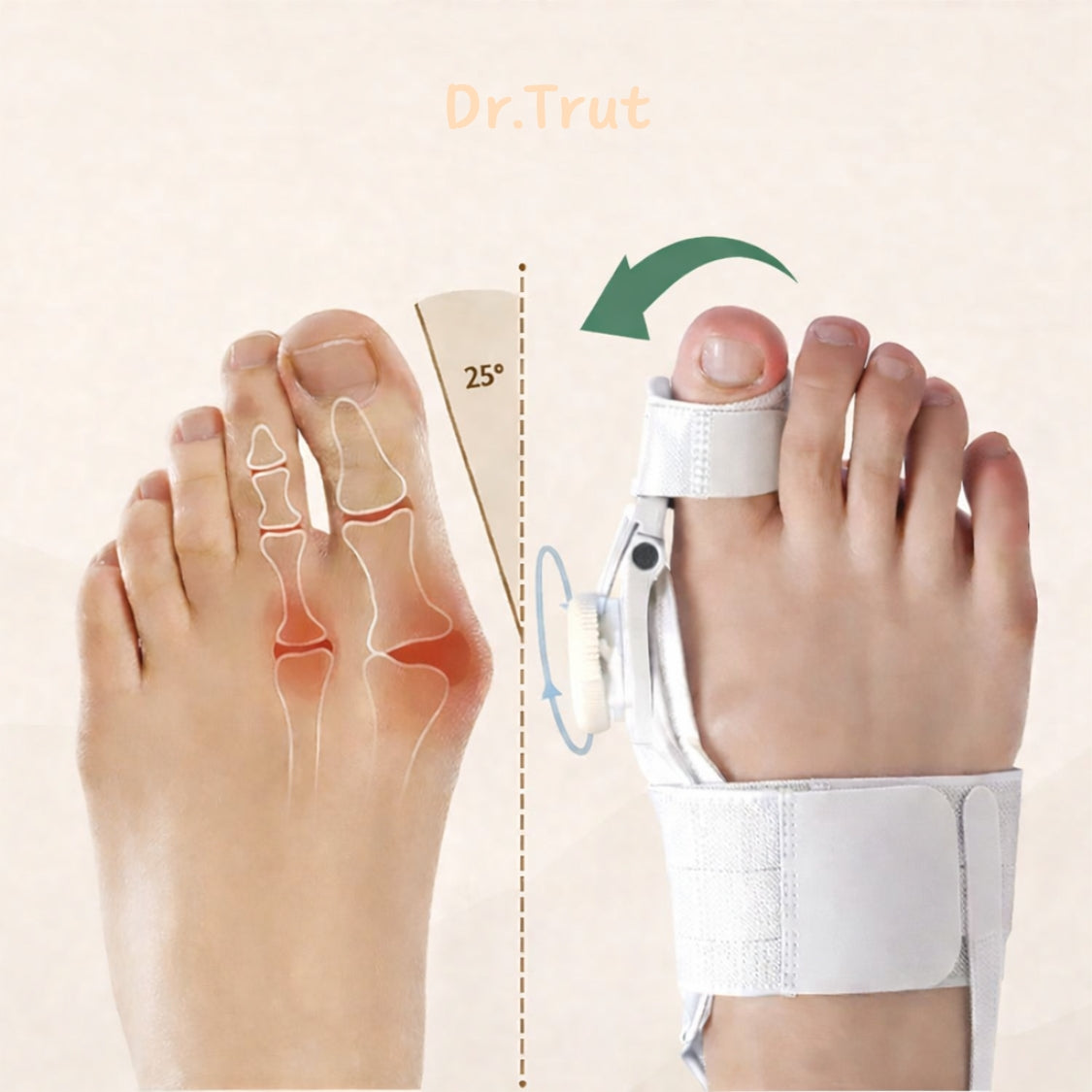 Dr. Trut™ Adjustable Toe Straightener